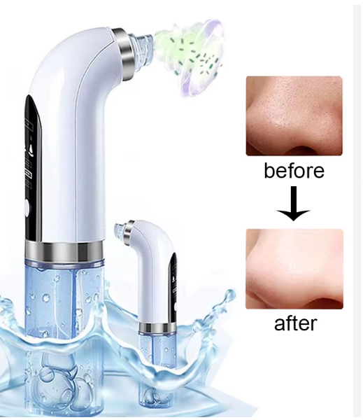 Miniatura 3 de extractor de espinillas a vapor